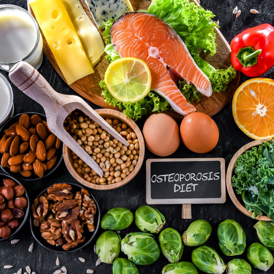 Bone-supportive foods including leafy greens, dairy and nuts.